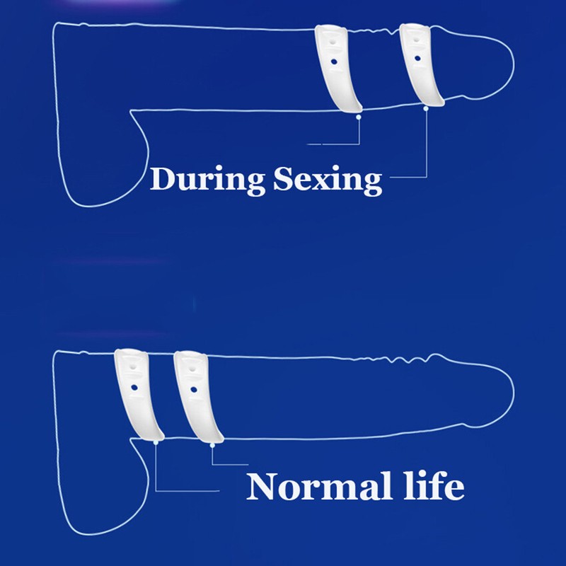 Foreskin Correction Cock Penis Ring Male Erection Stronger Sex Toy FOR Men Gays gallery